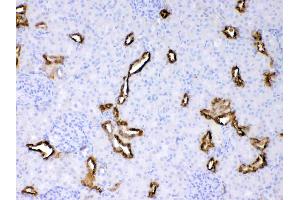Cytokeratin 18 was detected in paraffin-embedded sections of rat kidney tissues using rabbit anti- Cytokeratin 18 Antigen Affinity purified polyclonal antibody (Catalog # ) at 1 µg/mL.