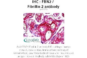 Image no. 1 for anti-Fibrillin 2 (FBN2) antibody (ABIN1734298) (Fibrillin 2 antibody)