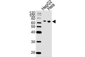 Lane 1: HepG2 Cell lysates, Lane 2: HeLa Cell lysates, probed with NLK (1146CT24. (Nemo-Like Kinase antibody)