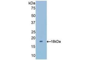 Detection of Recombinant RBP1, Human using Polyclonal Antibody to Retinol Binding Protein 1, Cellular (RBP1) (RBP1 antibody  (AA 2-135))