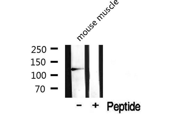 SKP2 antibody  (C-Term)