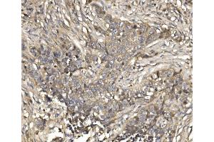 IHC analysis of EIF4EBP1 using anti-EIF4EBP1 antibody (ABIN7602881). (eIF4EBP1 antibody  (C-Term))