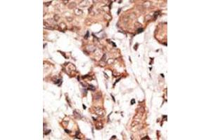 Image no. 2 for anti-Signal Transducer and Activator of Transcription 2, 113kDa (STAT2) (C-Term) antibody (ABIN357081)