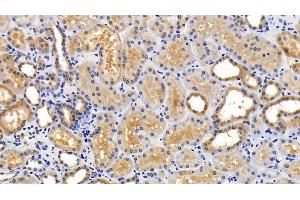 Detection of SQSTM1 in Human Kidney Tissue using Polyclonal Antibody to Sequestosome 1 (SQSTM1) (SQSTM1 antibody  (AA 136-400))