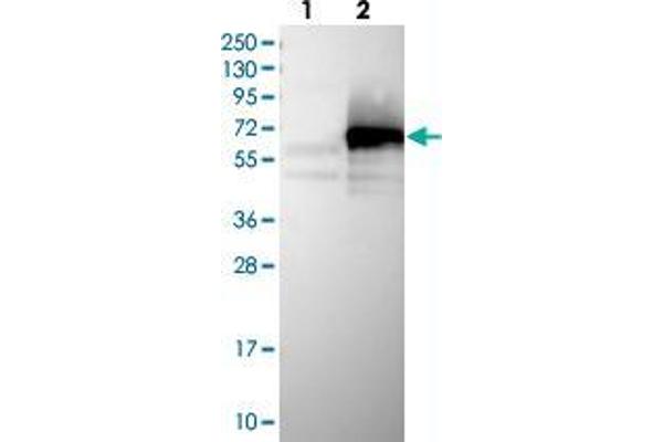 ZC3H15 anticorps
