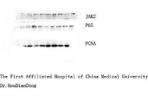 Western Blotting (WB) image for anti-Janus Kinase 2 (JAK2) (Ser642) antibody (ABIN6284346)