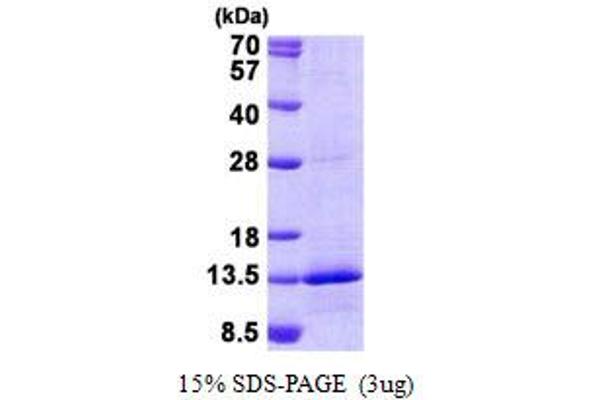 NDUFB4 Protein (His tag)