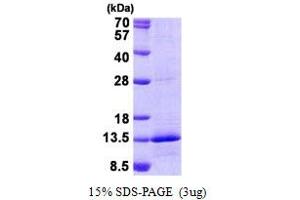 Image no. 1 for NADH Dehydrogenase (Ubiquinone) 1 beta Subcomplex, 4, 15kDa (NDUFB4) protein (His tag) (ABIN1098800) (NDUFB4 Protein (His tag))