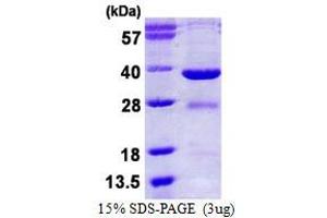 Image no. 1 for Eyes Absent Homolog 2 (Drosophila) (EYA2) (AA 244-514) protein (His tag) (ABIN1098596)