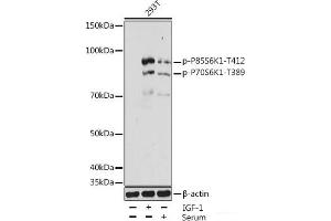 Western blot analysis of extracts of 293T cells using Phospho-P70S6K1(T389) Polyclonal Antibody at dilution of 1:1000. (RPS6KB1 antibody  (pThr389))