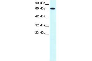 WB Suggested Anti-PIAS3 Antibody Titration:  1. (PIAS3 antibody  (C-Term))