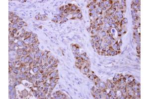 IHC-P Image TUFM antibody detects TUFM protein at mitochondria on H441 xenograft by immunohistochemical analysis. (TUFM antibody)