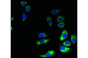 Immunofluorescent analysis of A549 cells using ABIN7154384 at dilution of 1:100 and Alexa Fluor 488-congugated AffiniPure Goat Anti-Rabbit IgG(H+L)