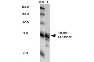Western Blot analysis of Rat Brain Membrane showing detection of LAR protein using Mouse Anti-LAR Monoclonal Antibody, Clone S165-38 .