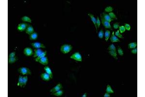 Immunofluorescent analysis of HepG2 cells using ABIN7169080 at dilution of 1:100 and Alexa Fluor 488-congugated AffiniPure Goat Anti-Rabbit IgG(H+L) (PKN2 antibody  (AA 925-969))