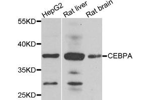 Western blot analysis of extracts of various cell lines, using CEBPA antibody. (CEBPA antibody)