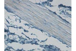 Immunohistochemical staining of formalin-fixed paraffin-embedded human stomach tissue showing cytoplasmic staining with CNN1 polyclonal antibody  at 1 : 100 dilution. (CNN1 antibody  (AA 150-250))