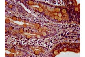 IHC image of ABIN7155790 diluted at 1:200 and staining in paraffin-embedded human small intestine tissue performed on a Leica BondTM system. (MEIS3 antibody  (AA 178-264))