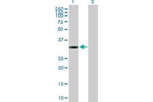 Western Blot analysis of ITPK1 expression in transfected 293T cell line by ITPK1 MaxPab polyclonal antibody. (ITPK1 antibody  (AA 1-314))