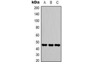Western blot analysis of Gamma-enolase expression in Hela (A), Jurkat (B), 293T (C) whole cell lysates. (ENO2/NSE antibody)