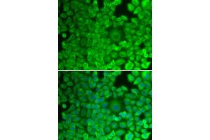 Immunofluorescence analysis of HeLa cells using GYS1 antibody (ABIN5971351). (Glycogen Synthase 1 antibody)