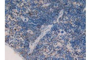 IHC-P analysis of Mouse Spleen Tissue, with DAB staining. (C1QA antibody  (AA 23-245))