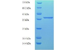 MLXIP Protein (AA 1-217, full length) (His-SUMO Tag)