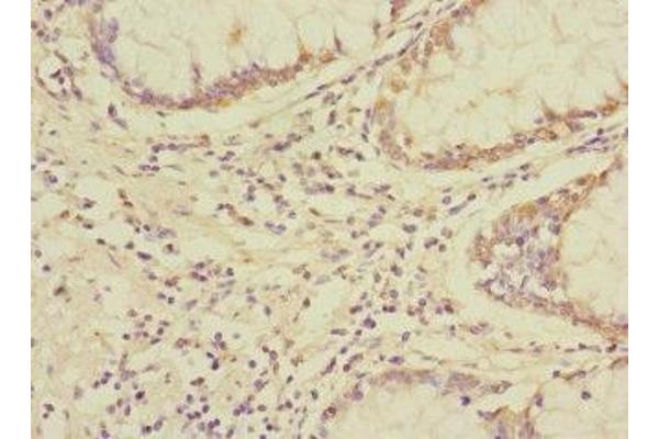 UBAP1 antibody  (AA 1-300)