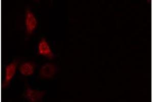 ABIN6275664 staining  HeLa cells by IF/ICC. (UBE2D2 antibody  (C-Term))