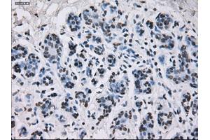 Immunohistochemical staining of paraffin-embedded breast tissue using anti-ID3 mouse monoclonal antibody. (ID3 antibody)