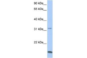TCAP antibody used at 1 ug/ml to detect target protein. (TCAP antibody)