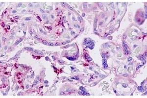 Human Placenta: Formalin-Fixed, Paraffin-Embedded (FFPE) (LGMN antibody  (AA 83-112))