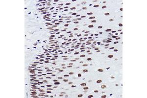 Immunohistochemistry of paraffin-embedded human esophageal using BRMS1 Rabbit mAb (ABIN7265928) at dilution of 1:100 (40x lens). (BRMS1 antibody)