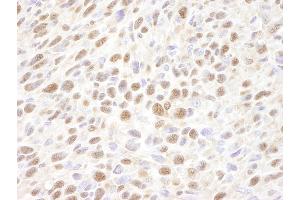 Immunohistochemistry (IHC) image for anti-Valosin Containing Protein (VCP) (C-Term) antibody (ABIN7448858) (VCP antibody  (C-Term))