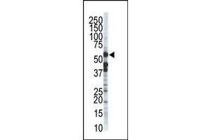 Image no. 1 for anti-Zinc Metalloproteinase, Ste24 (Zmpste24) (C-Term) antibody (ABIN357708) (ZMPSTE24 antibody  (C-Term))