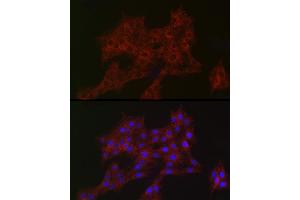 Immunofluorescence analysis of PC-12 cells using  Rabbit mAb (ABIN7265385) at dilution of 1:100 (40x lens). (ARPC2 antibody)