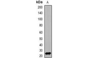 Western blot analysis of PSMD10 expression in SW620 (A) whole cell lysates. (PSMD10 antibody)