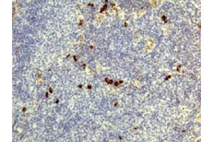 Immunohistochemical staining (Formalin-fixed paraffin-embedded sections) of human lymphoid tissue with Human IgD monoclonal antibody, clone RM123  under 1 ug/mL working concentration. (IgD antibody)