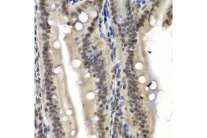 Immunohistochemistry of paraffin-embedded mouse Intestine using NELFE antibody.