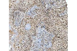 IHC analysis of RING2/RING1B/RNF2 using anti-RING2/RING1B/RNF2 antibody (ABIN7599286). (RNF2 antibody  (AA 1-336))