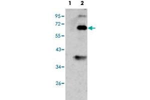 Western blot analysis of BMP3 (arrow) using BMP3 polyclonal antibody . (BMP3 antibody  (N-Term))