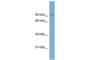 WB Suggested Anti-OSBPL1A Antibody Titration:  0.