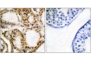 Immunohistochemistry analysis of paraffin-embedded human testis, using Retinoblastoma (Phospho-Thr821) Antibody. (Retinoblastoma Protein (Rb) antibody  (pThr821))