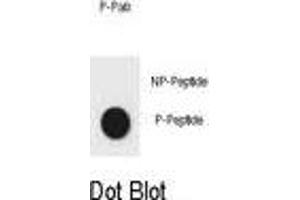 Dot blot analysis of CDKN2A Antibody (Phospho S8) Phospho-specific Pab (ABIN6241060 and ABIN6578940) on nitrocellulose membrane.