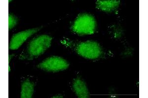 Immunofluorescence of purified MaxPab antibody to CCL27 on HeLa cell. (CCL27 antibody  (AA 1-112))