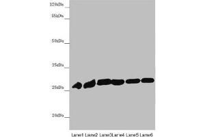 Western blot All lanes: PGLS antibody at 4. (PGLS antibody  (AA 1-258))