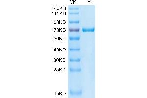 GAS6 Protein (AA 31-637) (His tag)