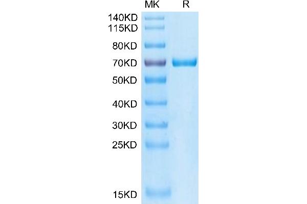 GAS6 Protein (AA 31-637) (His tag)