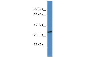 Western Blotting (WB) image for anti-Golgin A6 Family-Like 2 (GOLGA6L2) (Middle Region) antibody (ABIN2788891) (GOLGA6L2 antibody  (Middle Region))