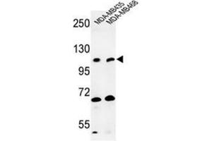 Western blot analysis of EXTL3 Antibody (N-term) in MDA-MB435, MDA-MB468 cell line lysates (35ug/lane).